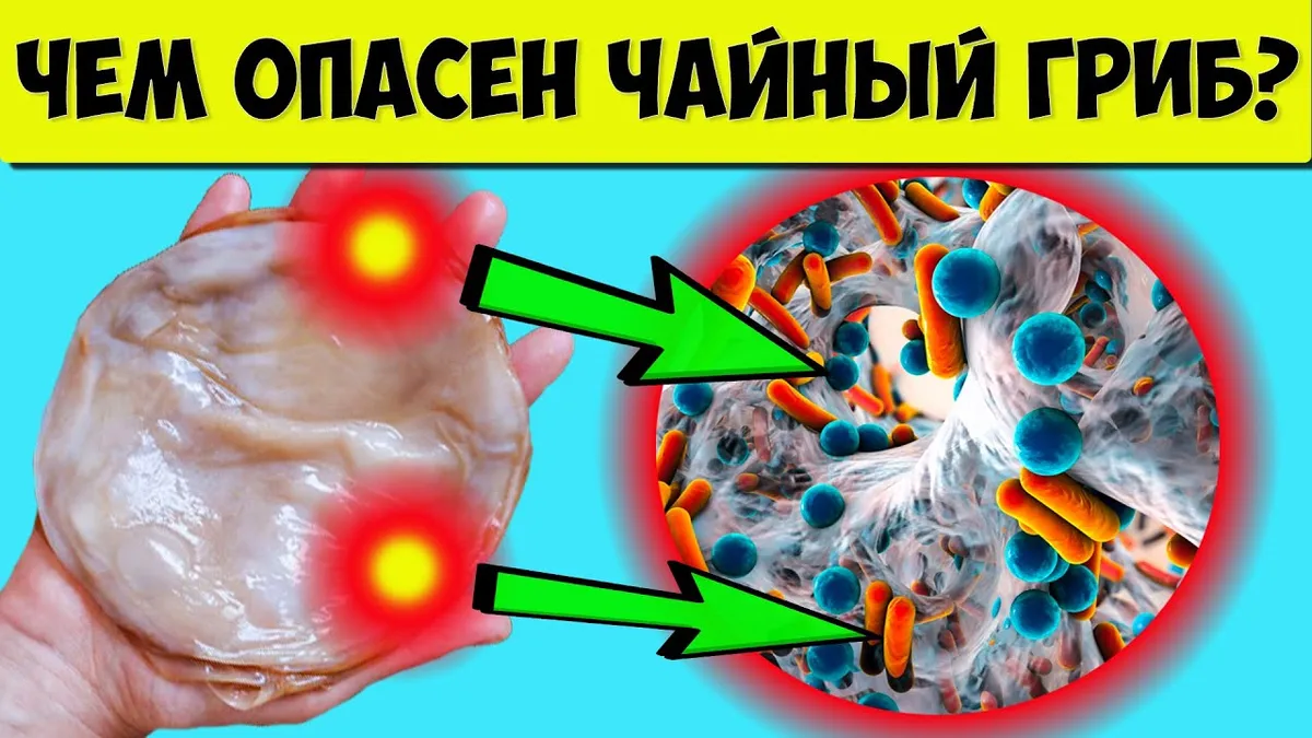 Чем опасен чайный гриб?